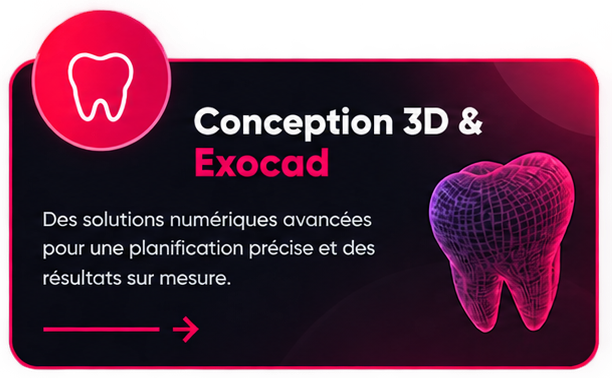 Conception 3D & Exocad